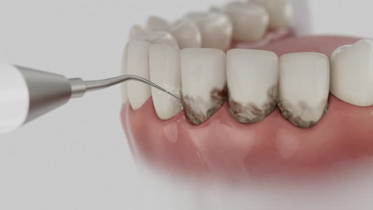 Reliable Tooth Extraction contractor in Laclede County County, MO by Dentist Open Now
